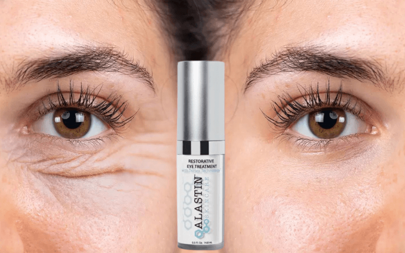 Alastin Skincare Eye Cream